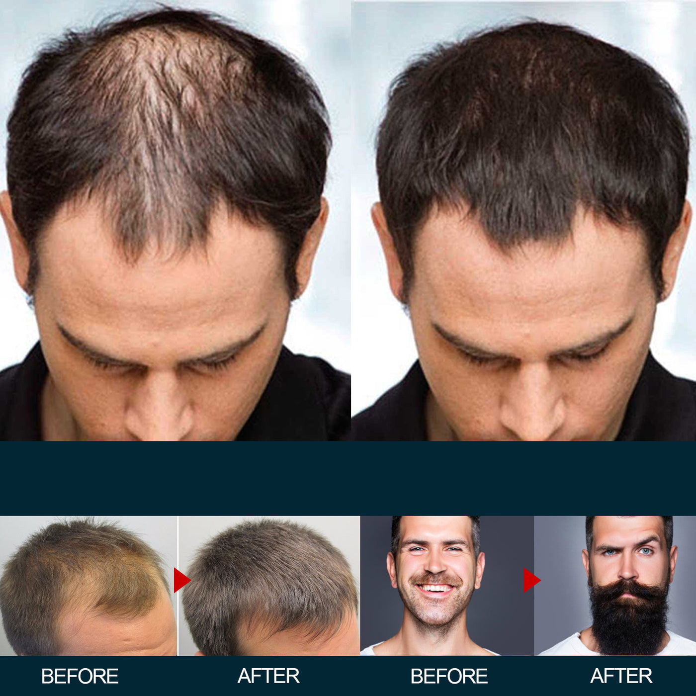 Men's Hair Nutrition Care Anti-hair Fixing Thick Moisturizing