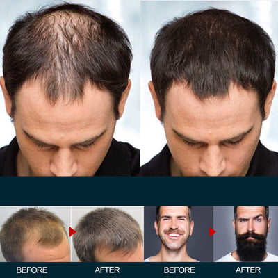 Men's Hair Nutrition Care Anti-hair Fixing Thick Moisturizing
